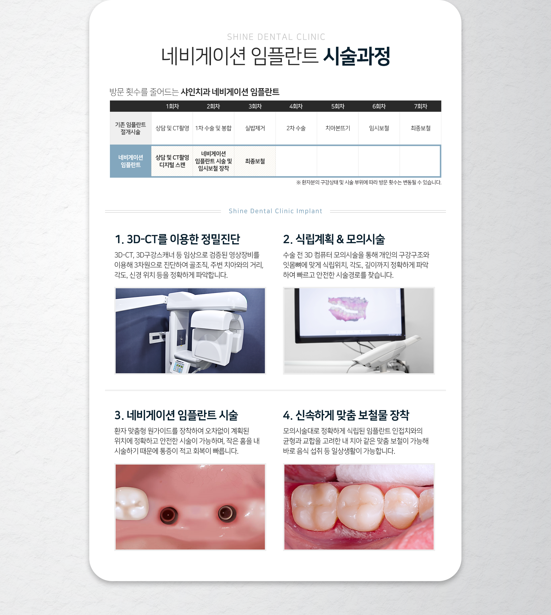 시술-과정-1단계-3D_CT-3D-구강-스캐너-등-임상으로-검증된-영상장비를-이용해-3차원으로-진단하여-골조직-주변-치아와의-거리-각도-신경-위치-등을-정확하게-파악합니다-2단계-수술-전-3D-컴퓨터-모의-시술을-통해-개인의-구강구조와-잇몸뼈에-맞게-식립-위치-각도-깊이까지-정확하게-파악하여-빠르고-안전한-시술-경로를-찾습니다-3단계-환자-맞춤형-원가이드를-장착하여-오차-없이-계획된-위치에-정확하고-안전한-시술이-가능하며-작은-홈을-내-시술하기-때문에-통증이-적고-회복이-빠릅니다-4단계-모의-시술대로-정확하게-식립된-임플란트-인접치와의-균형과-교합을-고려한-내-치아-같은-맞춤-보철이-가능해-바로-음식-섭취-등-일상생활이-가능합니다