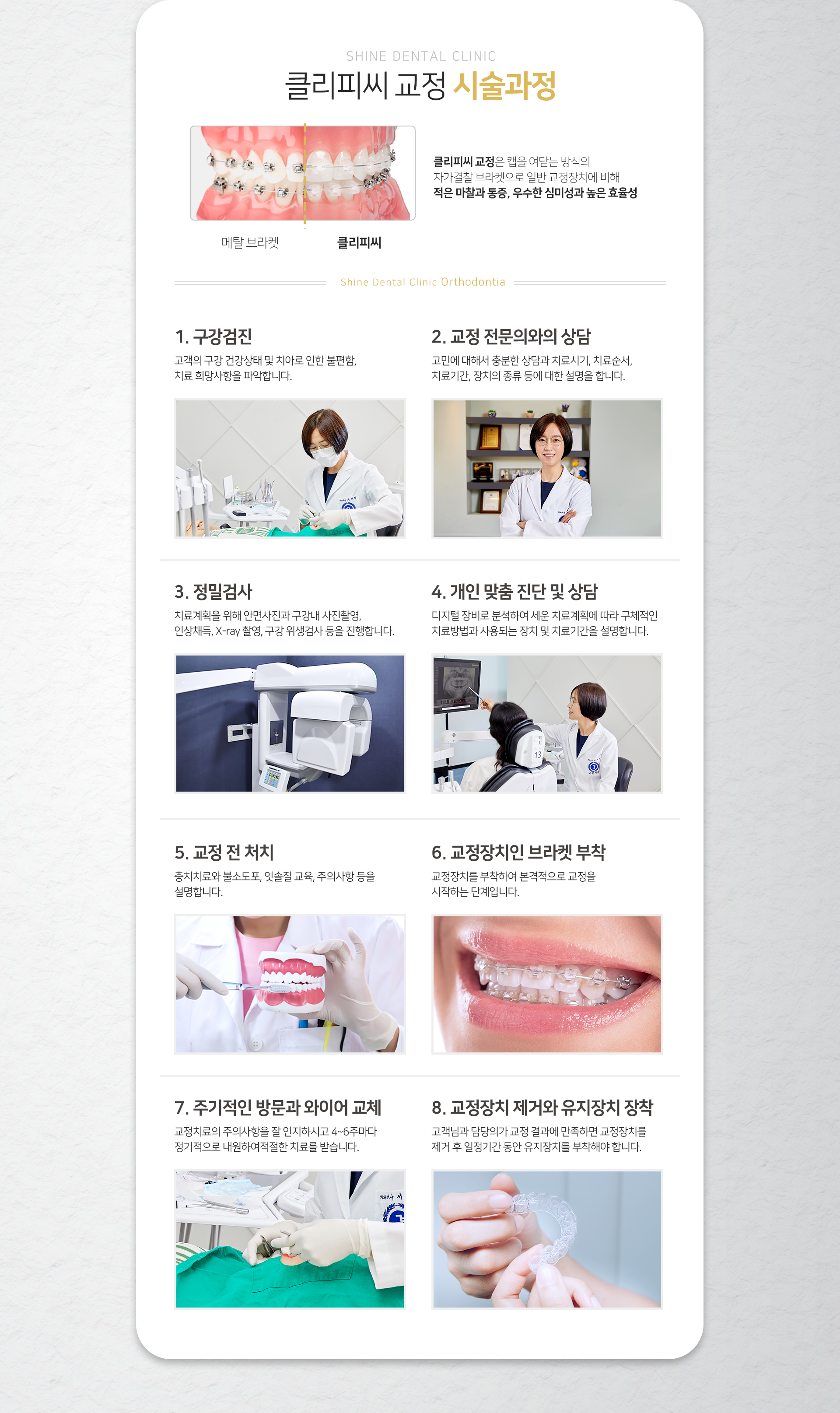 클리피씨-교정-시술-과정-1단계-구강검진-2단계-교정-전문의와의-상담-3단계-정밀검사-4단계-개인-맞춤-진단-및-상담-5단계-교정-전-처치-6단계-교정장치인-브라켓-부착-7단계-주기적인-방문과-와이어-교체-8단계-교정장치-제거와-유지-장치-장착