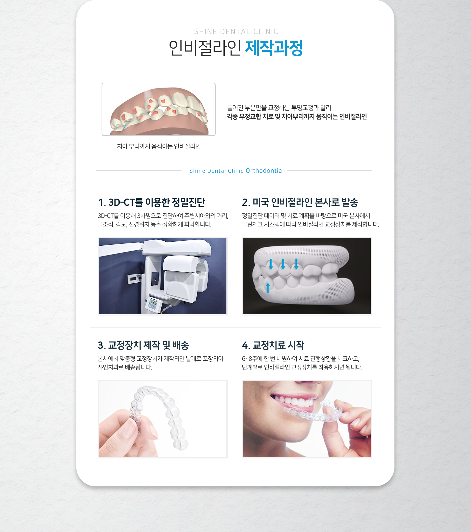 인비절라인-제작-과정-1단계-3D_CT를-이용한-정밀진단-3D_CT를-이용해-3차원으로-진단하여-주변-치아와의-거리-골조직-각도-신경-위치-등을-정확하게-파악합니다-2단계-미국-인비절라인-본사로-발송-정밀진단-데이터-및-치료-계획을-바탕으로-미국-본사에서-클린체크-시스템에-따라-인비절라인-교정장치를-제작합니다-3단계-교정장치-제작-및-배송-본사에서-맞춤형-교정장치가-제작되면-낱개로-포장되어-샤인치과로-배송됩니다-4단계-교정치료-시작-6~8주에-한-번-내원하여-치료-진행-상황을-체크하고-단계별로-인비절라인-교정장치를-착용하시면-됩니다