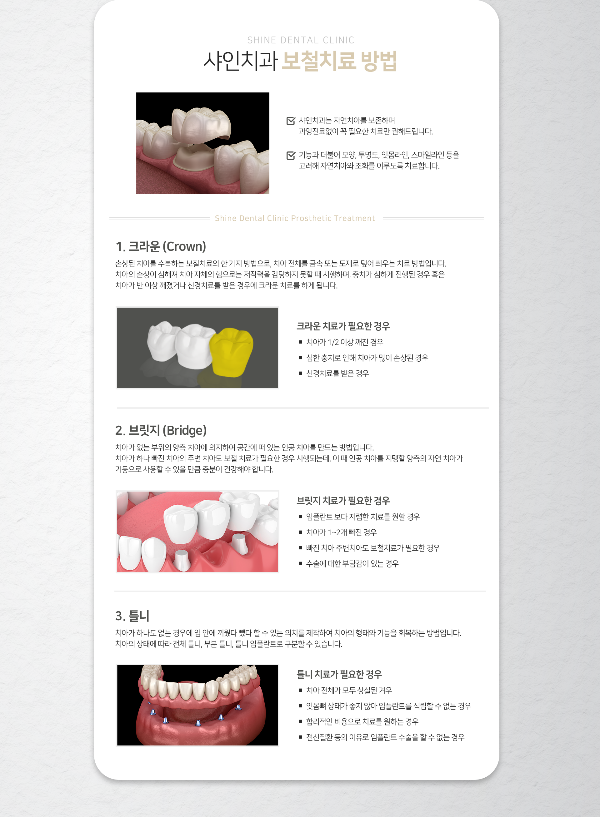 보철치료-방법1-크라운-치아가-2분의-1-이상-깨진-경우-심한-충치로-인해-치아가-많이-손상된-경우-신경치료를-받은-경우-방법2-브릿지-임플란트보다-저렴한-치료를-원할-경우-치아가-1~2개-빠진-경우-빠진-치아-주변-치아도-보철치료가-필요한-경우-수술에-대한-부담감이-있는-경우-방법3-틀니-치아-전체가-모두-상실된-경우-잇몸뼈-상태가-좋지-않아-임플란트를-식립할-수-없는-경우-합리적인-비용으로-치료를-원하는-경우-전신질환-등의-이유로-임플란트-수술을-할-수-없는-경우