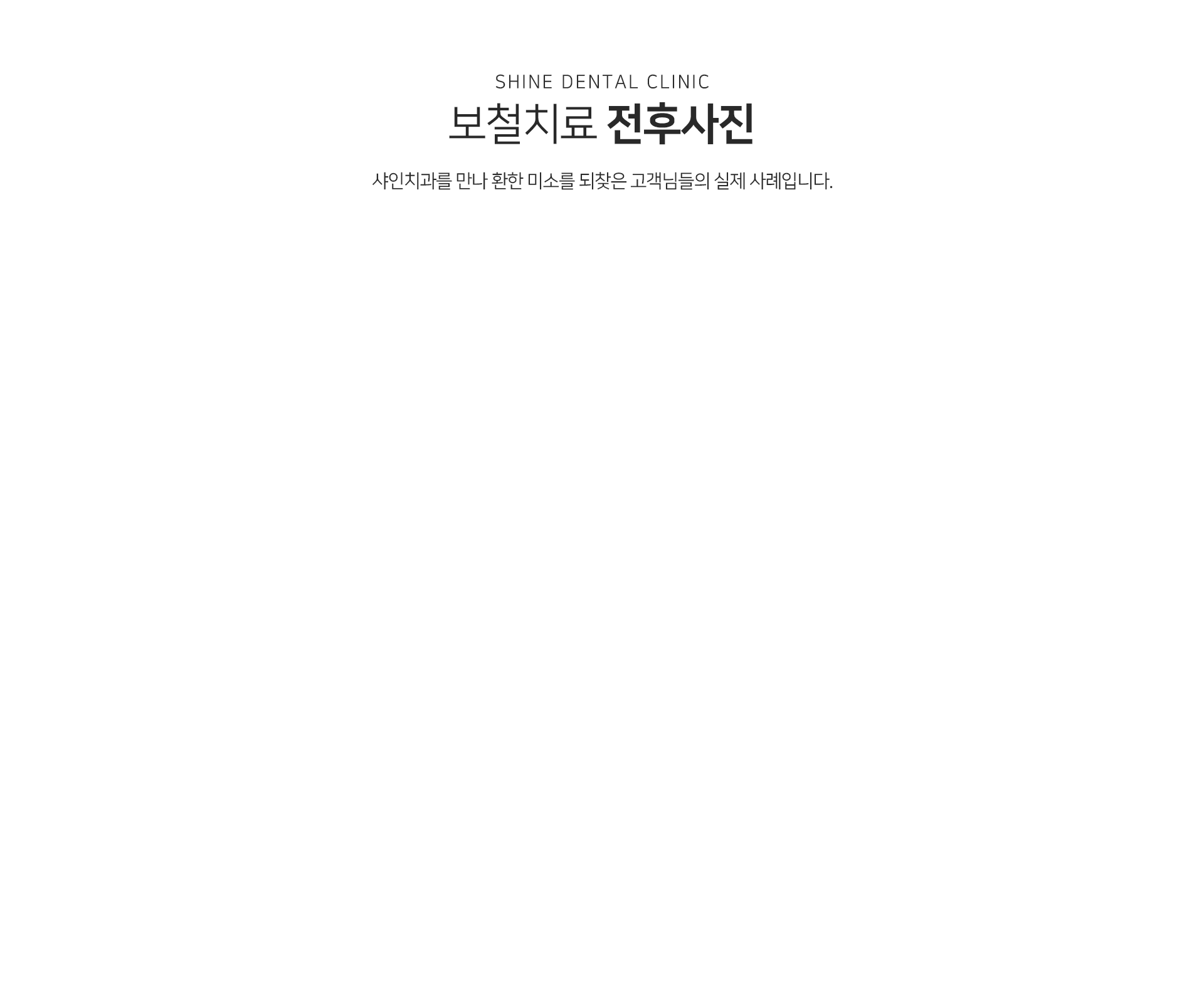 보철치료-전후사진-샤인치과를-만나-환한-미소를-되찾은-고객님들의-실제-사례입니다