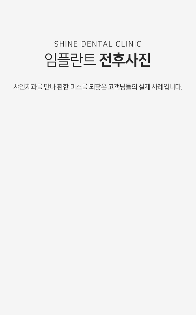 임플란트-전후사진-샤인치과를-만나-환한-미소를-되찾은-고객님들의-실제-사례입니다