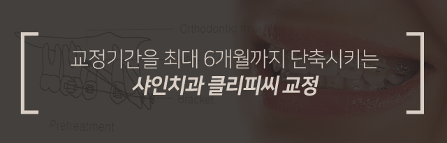 교정-기간을-최대-6개월까지-단축시키는-샤인치과-클리피씨-교정