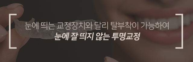눈에-띄는-교정장치와-달리-탈부착이-가능하여-눈에-잘-띄지-않는-투명교정