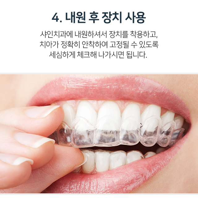 4단계-내원-후-장치-사용-내원하셔서-장치를-착용하고-치아가-정확히-안착하여-고정될-수-있도록-세심하게-체크해-나가시면-됩니다