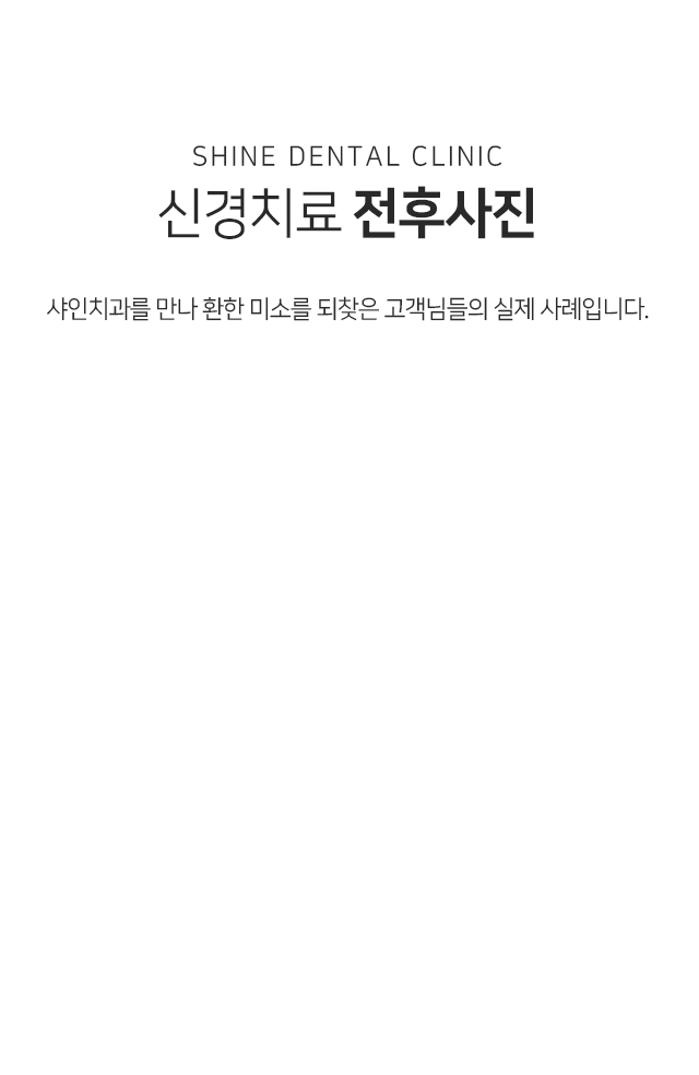 신경치료-전후사진-샤인치과를-만나-환한-미소를-되찾은-고객님들의-실제-사례입니다