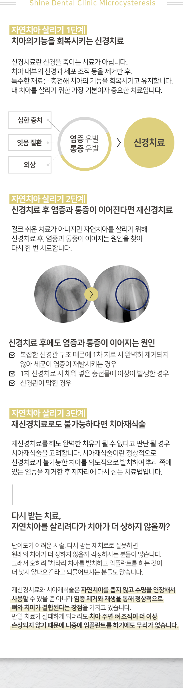자연치아-살리기-1단계-치아의-기능을-회복시키는-신경치료-치아-내부의-신경과-세포-조직-등을-제거한-후-특수한-재료를-충전해-치아의-기능을-회복시키고-유지합니다-2단계-신경치료-후-염증과-통증이-이어진다면-재신경치료-자연치아를-살리기-위해-신경치료-후-염증과-통증이-이어지는-원인을-찾아-다시-한번-치료합니다-3단계-재신경치료로도-불가능하다면-치아재식술-정상적으로-신경치료가-불가능한-치아를-의도적으로-발치하여-뿌리-쪽에-있는-염증을-제거한-후-제자리에-다시-심는-치료법입니다