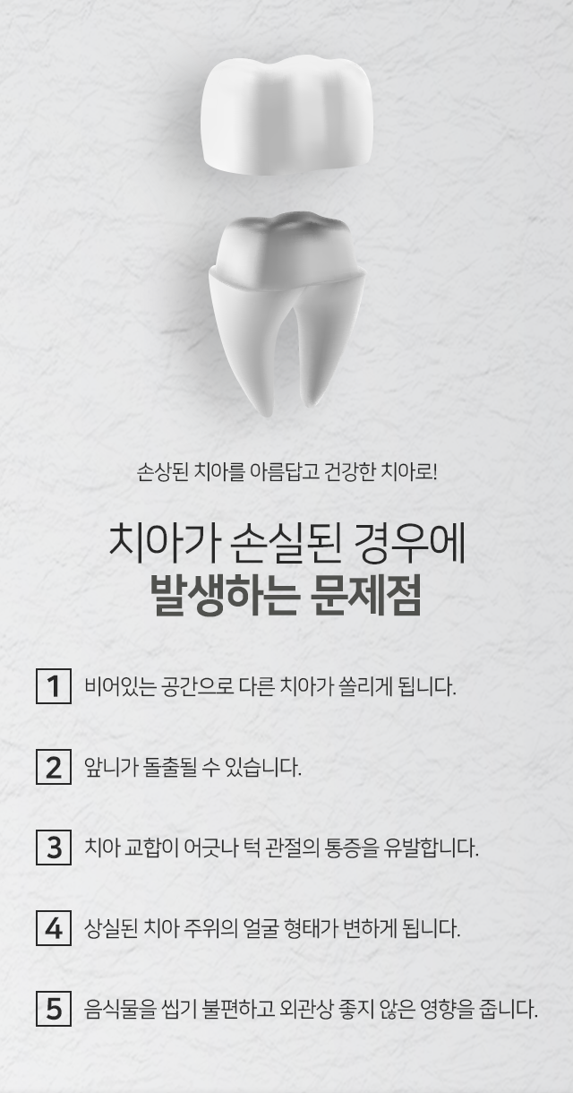치아가-손실된-경우에-발생하는-문제점-비어있는-공간으로-다른-치아가-쏠리게-됩니다-앞니가-돌출될-수-있습니다-치아-교합이-어긋나-턱관절의-통증을-유발합니다-상실된-치아-주위의-얼굴-형태가-변하게-됩니다-음식물을-씹기-불편하고-외관상-좋지-않은-영향을-줍니다