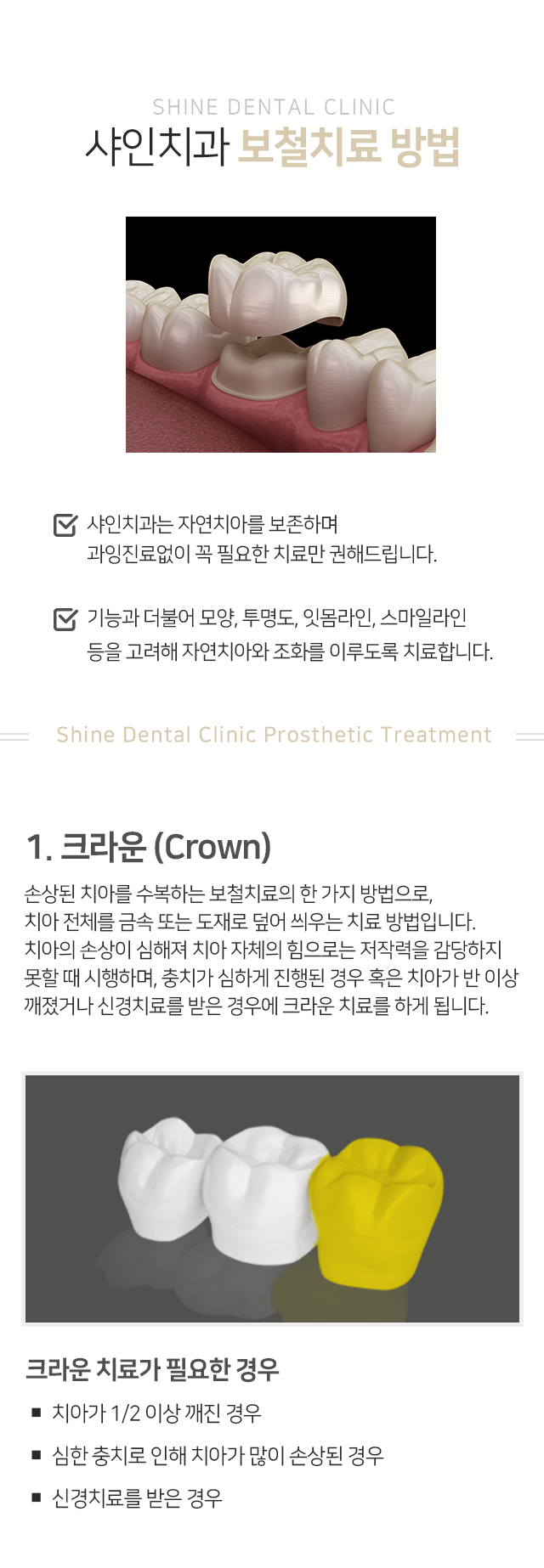 보철치료-방법-샤인치과는-자연치아를-보존하며-과잉진료-없이-꼭-필요한-치료만-권해드립니다-기능과-더불어-모양-투명도-잇몸라인-스마일라인-등을-고려해-자연치아와-조화를-이루도록-치료합니다-방법1-크라운-치아가-2분의-1-이상-깨진-경우-심한-충치로-인해-치아가-많이-손상된-경우-신경치료를-받은-경우
