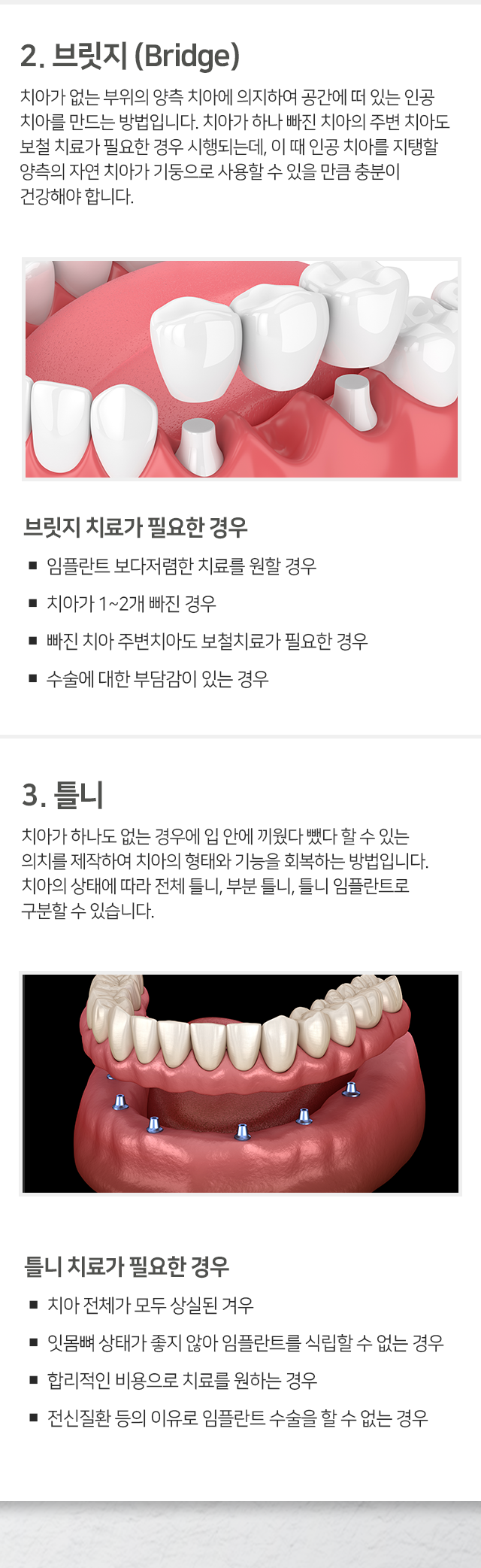 방법2-브릿지-임플란트보다-저렴한-치료를-원할-경우-치아가-1~2개-빠진-경우-빠진-치아-주변-치아도-보철치료가-필요한-경우-수술에-대한-부담감이-있는-경우-방법3-틀니-치아-전체가-모두-상실된-경우-잇몸뼈-상태가-좋지-않아-임플란트를-식립할-수-없는-경우-합리적인-비용으로-치료를-원하는-경우-전신질환-등의-이유로-임플란트-수술을-할-수-없는-경우