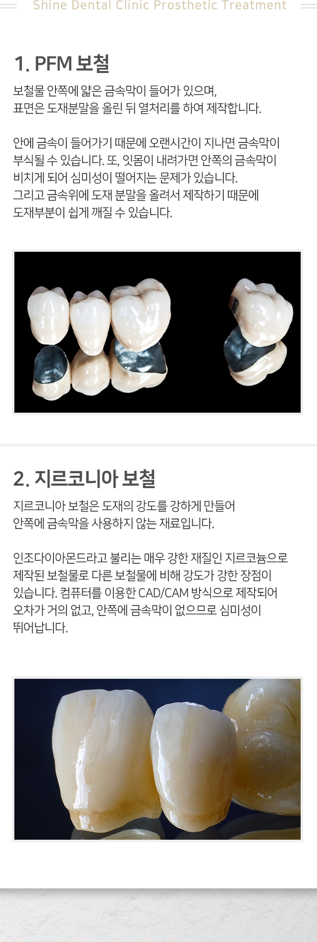 보철치료-종류1-PFM-보철-보철물-안쪽에-얇은-금속막이-들어가-있으며-표면은-도재분말을-올린-뒤-열처리를-하여-제작합니다-안에-금속이-들어가기-때문에-오랜-시간이-지나면-금속막이-부식될-수-있습니다-또-잇몸이-내려가면-안쪽의-금속막이-비치게-되어-심미성이-떨어지는-문제가-있습니다-종류2-지르코니아-보철-도재의-강도를-강하게-만들어-안쪽에-금속막을-사용하지-않는-재료입니다-컴퓨터를-이용한-CAD/CAM-방식으로-제작되어-오차가-거의-없고-안쪽에-금속막이-없으므로-심미성이-뛰어납니다