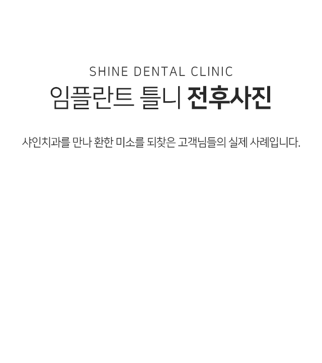 임플란트-틀니-전후사진-샤인치과를-만나-환한-미소를-되찾은-고객님들의-실제-사례입니다