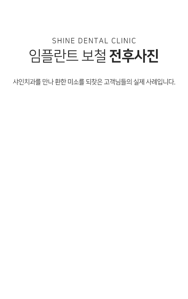 임플란트-보철-전후사진-샤인치과를-만나-환한-미소를-되찾은-고객님들의-실제-사례입니다