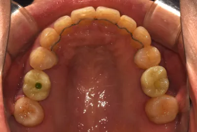 치료 전후 비교 사진(정면)