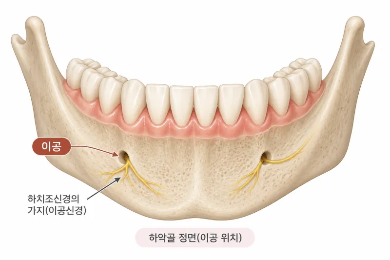 이공 위치 표시 사진