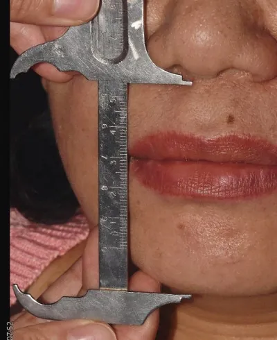 치아 상태를 유지하며 치료를 계획하는 과정의 사진
