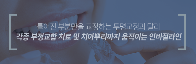 틀어진-부분만을-교정하는-투명교정과-달리-각종-부정교합-치료-및-치아-뿌리까지-움직이는-인비절라인