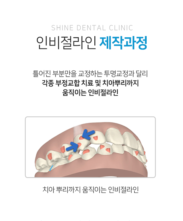 인비절라인-제작-과정