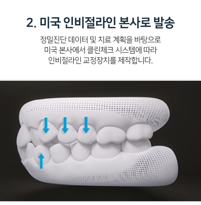 2단계-미국-인비절라인-본사로-발송-정밀진단-데이터-및-치료-계획을-바탕으로-미국-본사에서-클린체크-시스템에-따라-인비절라인-교정장치를-제작합니다
